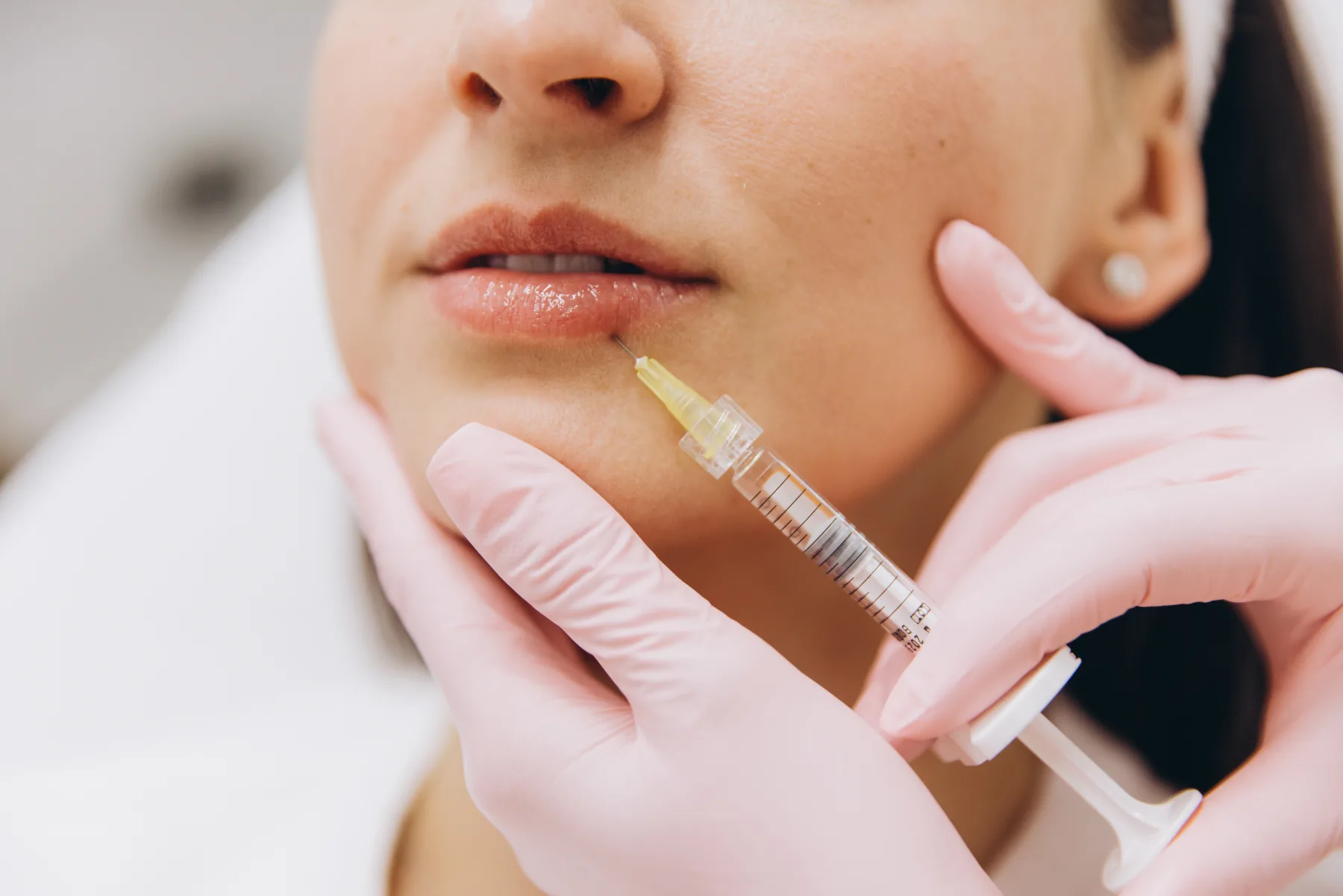 Dermal filler treatment direction