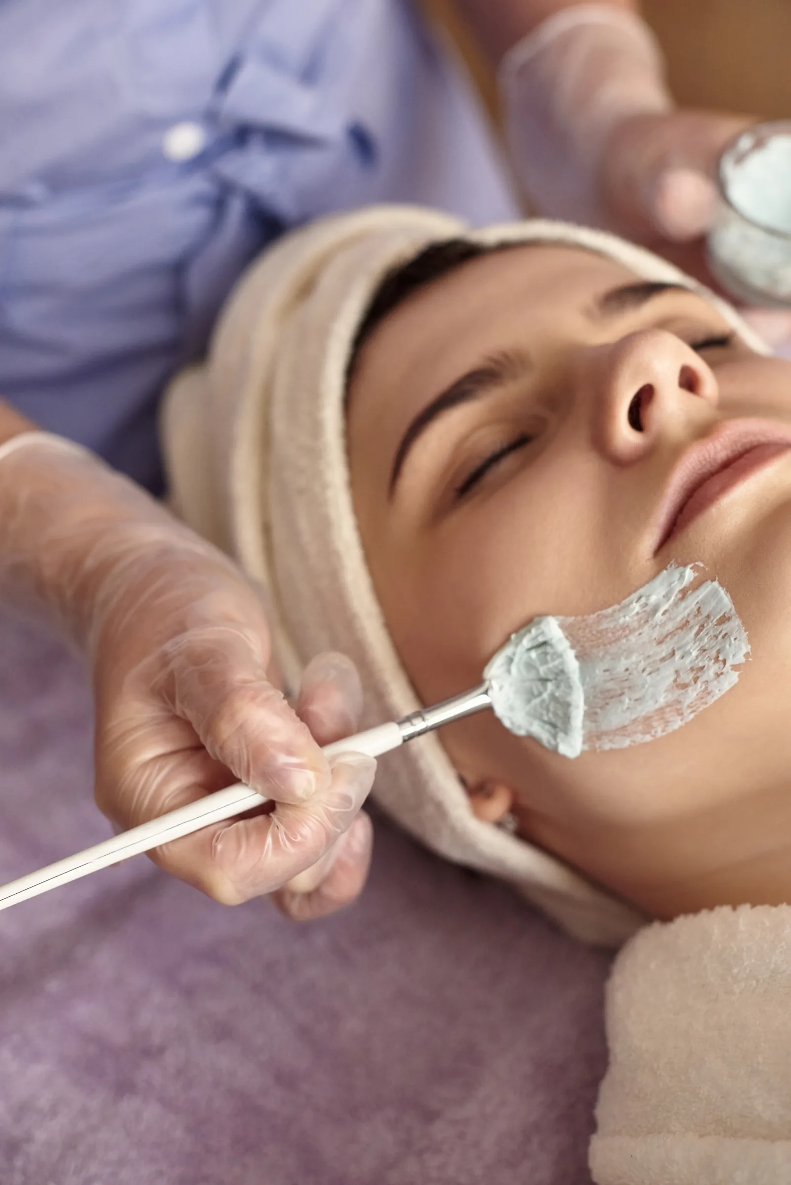 Chemical peel treatment direction